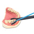 SDFlosser SDF Delivery System, Trial Pack...