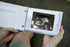 Pregnancy/Maternity Ultrasound And Photo Album/Keepsake...