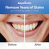 AquaSonic Power Bright Teeth Whitening 3-in-1 Kit | 2 Whitening Gel Syringes | 1 Blue LED Light Mouthpiece | 1 Whitening Pen | Easy Safe Fast Resu...