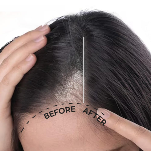 Scalp Intensive Shampoo - Peptide Shampoo Anti-Hair Loss Shampoo for Men Women Korean Hair Regrowth & Thickening with Panthenol Biotin, Paraben Fr...