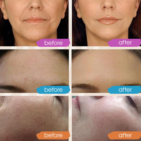 Retinol Serum for Face - Vitamin C Face Serum with Hyaluronic Acid Serum for Face, Vitamin C Serum for Face, Retinol for Face, Glow Face Serum for...