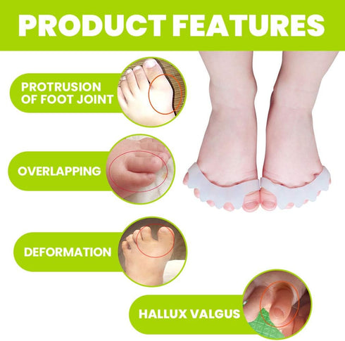 GloDeals Bunion Corrector 6 PCS Kids Toe Separator, Kids Toe Separator Soft Gel Bunion Pad&Spacer Kit Bunion Cushions Drift Pain Pads for Feet Ove...