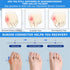 Bunion Corrector Women Men Big Toe, Adjustable Orthopedic Bunion Splint 2 Pcs Bunion Pads for Hallux Valgus Pain Relief Non-Slip Toe Straightener...