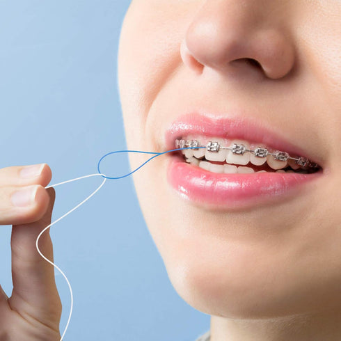 Floss Threaders for Braces, Bridges, and Implants 300 Count (Pack of 6)...