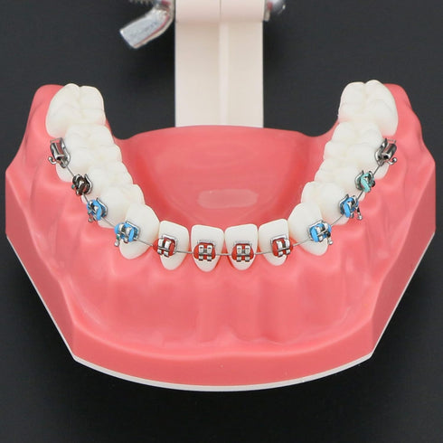 Orthodontic Model Dental Models 1:1 Standard Typodont Teeth Model M7010-2 Demo Teach Study with Archwire Ligature Ties Metal Brackets Buccal Tubes...