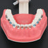 Orthodontic Model Dental Models 1:1 Standard Typodont Teeth Model M7010-2 Demo Teach Study with Archwire Ligature Ties Metal Brackets Buccal Tubes...