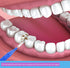50 Pcs Interdental Brushes 4 Sizes, Dental Soft Toothpicks Braces Brushes Go Between Teeth Gum?Oral Hygiene Slim Brushes Cleaning Tool...