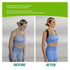 YUYTE Back Posture Correct Brace, 8 Shaped Adjust Straps Hunchback Prevention Back Straightener, Adjustable & Breathable for Bad Posture, Slumping...