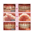Dental Orthodontic Bracket for Teeth Brace 20PCS Mini Metal Braces Roth/MBT Slot. Roth/MBT 022 3/345 Hooks (MBT 022 345 with Hooks)...