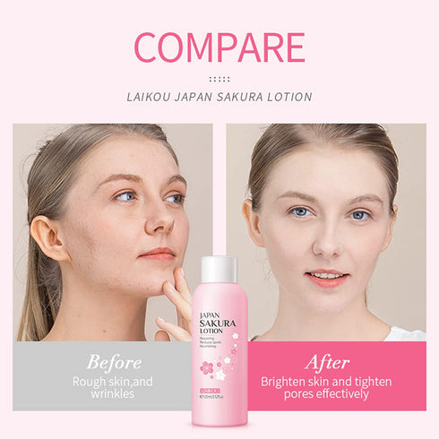 Sakura Face Lotion Moisturizing Essence for Shrink Pores Skin Daily Care, Toner Lotion Hydrating Repair Face Cream Vitamin C Serum Improve Skin No...