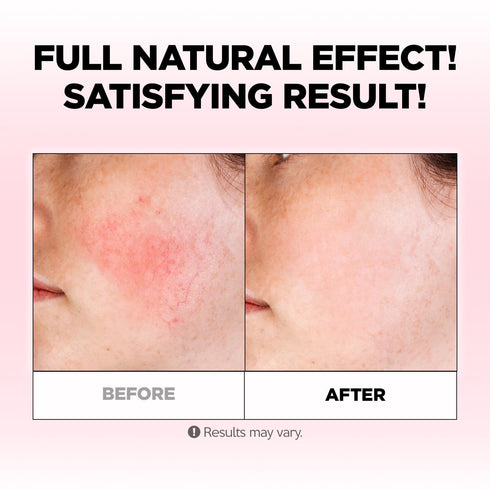 FARMSKIN Pink Vera Soothing Cream (100ml, 3.38oz) - Korean Skincare Moisturizer for Face & Body/Aloe Vera for Sunburn Relief/Non-Greasy/Korean Ski...