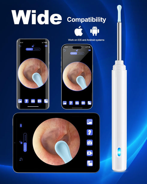 Ear Wax Removal Tool Camera, Ear Cleaner with Camera, Ear Cleaning Kit 1296P HD Ear Scope, 6 LED Lights and 6 Ear Picks, Earwax Removal with Otosc...