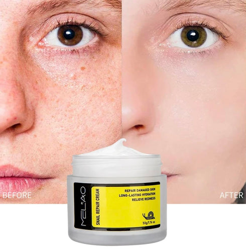 Snail Mucin 92% Moisturizer, Daily Repair Face Gel Cream for Dry Skin,Sensitive Skin, No Parabens, No Sulfates, No Phthalates, Korean Skincare 1.7...