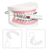Denture Bath Box Cup,Denture Bath Case with Strainer Basket,Orthodontic Retainer box,Retainer Cleaning Box,Soak Cup Fixed box?With braces chewable...