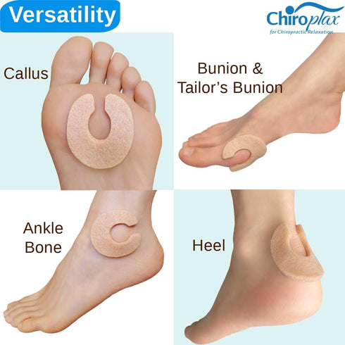 Chiroplax C-Shaped Felt Callus Cushion Pads Protector Rubbing Pain Relief Forefoot Metatarsal | 3/16" Thick (48 Pack)...