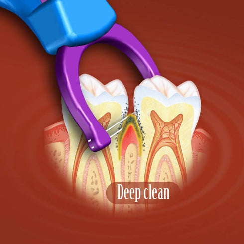 Evolutionary Clean Dental Flossers, Kit of Refills Plus Long Handle (200 T-Tension Refills)...