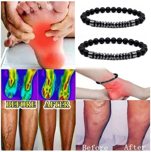 CSIYANJRY99 Lymphatic Drainage Anklet Anti-Swelling Black Obsidian Anklet Therapy Obsidian Bracelet for Women Men...