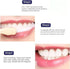 2PCS Sp-6 Ultra Whitening Toothpaste, Sp-6 Probiotic Toothpaste, sp-6 Ultra Whitening, Probiotic Brightening Toothpaste,Deep Cleaning Care Toothpa...
