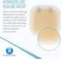 Dynarex DynaDerm Hydrocolloid Dressing, Sterile Moist Bandages Used for All Kinds of Wound, 2" x 2", Thin and Latex-Free, Pack of 20...