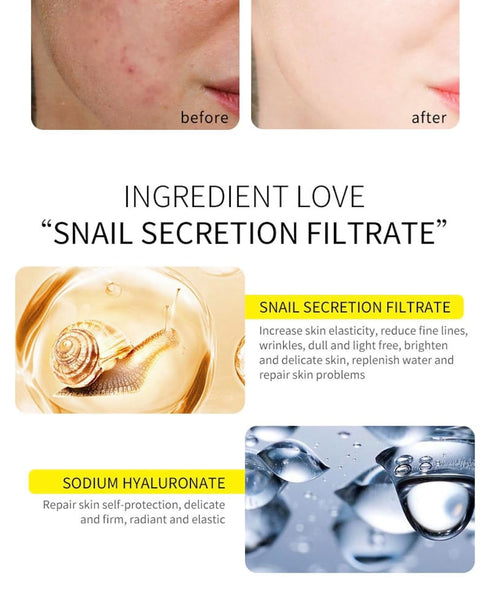 Snail Mucin 92% Moisturizer, Daily Repair Face Gel Cream for Dry Skin,Sensitive Skin, No Parabens, No Sulfates, No Phthalates, Korean Skincare 1.7...