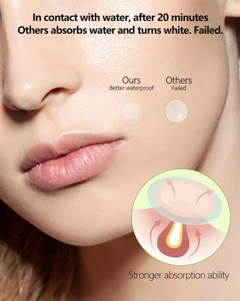 Pimple Patches for Face 66 Counts, 2 Sizes Thinner Edge Hydrocolloid Acne Patches for Face, Invisible Zit Patches for Face, Facial Skin Care Produ...