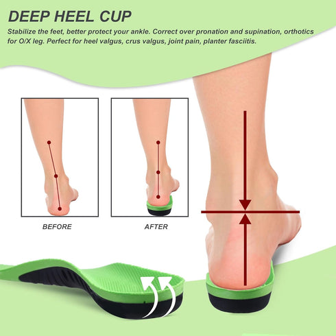 Kids Orthotic Arch Support Insoles, Plantar Fasciitis Cushioning Shoe Inserts, Shock Absorption Velvet Surfaces Deep Heel Cup Chinldren Inner Sole...