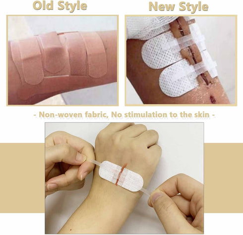 Emergency Wound Closures Adhesive Bandages, Zip Stitch Stickers for Camping, Survival & Household Gear, 3 Pcs (70 * 22mm, White)...