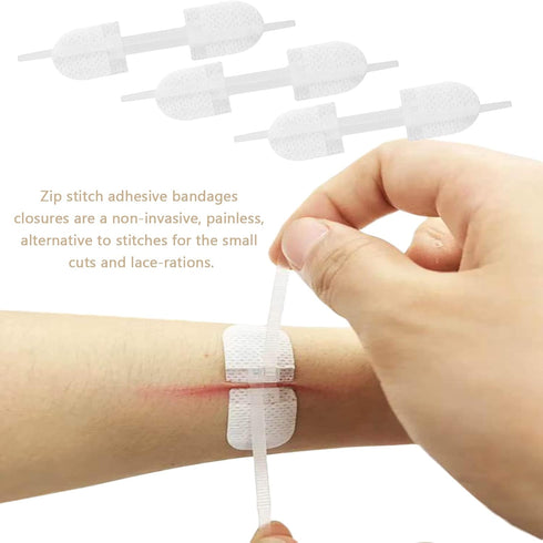 Emergency Wound Closures Adhesive Bandages, Zip Stitch Stickers for Camping, Survival & Household Gear, 3 Pcs (70 * 22mm, White)...