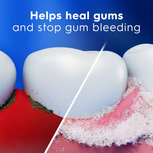 Crest Pro-Health Gum Detoxify Deep Clean Toothpaste 2.6 oz - Anticavity, Antibacterial Flouride Toothpaste, Clinically Proven, Gum and Enamel Prot...