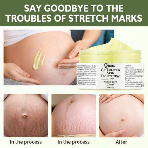 Stretch Marks and Scars Removal Cream for Pregnancy - Scars Repair, Abdominal Firming, and Gentle Stretch Marks Eradication Skincare Body...