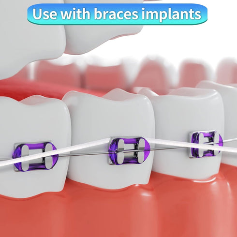 Easy-to-Use Sponge Floss for Cleaning of Implants Bridges with Stiff Plastic Ends and Sponge Floss Oral Hygiene (2)...