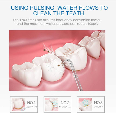 Dental Water Flosser nozzles, TUREWELL 7PCS Replacement Standard and Functional Jet Tips for Family Oral Irrigator FC165, FC168, FC169, FC166, FC1...
