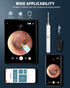 Ear Wax Removal, Ear Cleaner with Camera and Light, Ear Wax Removal Kit with 1296P Otoscope, Ear Cleaning Tool with 6 Ear Spoon, Ear Camera for iP...