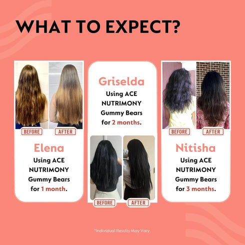 Balanced Beauty Biotin Gummies for Healthy Hair Skin & Nails, Helps Reduce Hairfall, Hair Growth Vitamins with Clinically Proven Keranat, Biotin &...