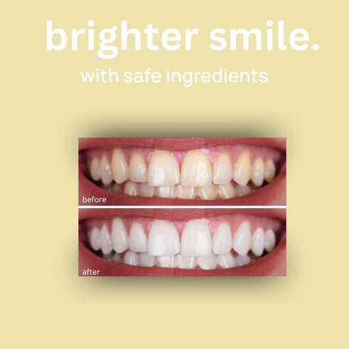Optivida Health- Hydroxyapatite Toothpaste| Teeth Whitening Toothpaste W/Nano Silver Fluoride Free | Supports Gum Health & Remineralization for Se...