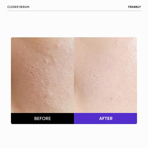 Frankly Closer Serum - 9 Peptides & Vegan Collagen, Pore Minimizer & Anti-Aging, Dewy Skin Hydrator, EWG Green, Non-Sticky, Derm-Tested, 2.03 fl. ...