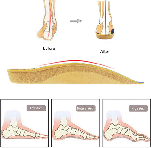 Arch Support, RooRuns 3/4 Orthotic Shoe Inserts for Over-Pronation, Plantar Fasciitis, Heel Pain Relief, High Arch Support Insoles for Men and Wom...