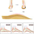 Arch Support, RooRuns 3/4 Orthotic Shoe Inserts for Over-Pronation, Plantar Fasciitis, Heel Pain Relief, High Arch Support Insoles for Men and Wom...