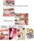 Dental Oral Care Orthodontics Wax with Fruit Smell for Brace Wearers Flavored Gum Protection (6 Boxes)...