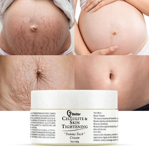 Stretch Marks and Scars Removal Cream for Pregnancy - Scars Repair, Abdominal Firming, and Gentle Stretch Marks Eradication Skincare Body...