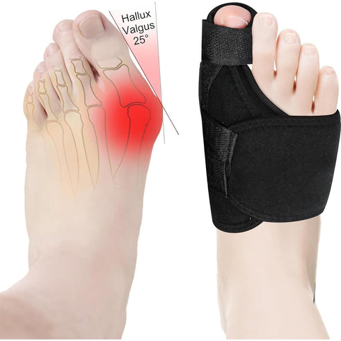 Bunion Corrector Women Men Big Toe, Adjustable Orthopedic Bunion Splint 2 Pcs Bunion Pads for Hallux Valgus Pain Relief Non-Slip Toe Straightener...