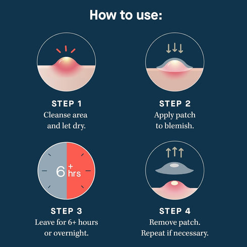 SLMD by Dr. Pimple Popper Salicylic Acid Pimple Patches - Treat Acne and Improve the Appearance of Dark Spots - Thin Transparent Patches with Sali...