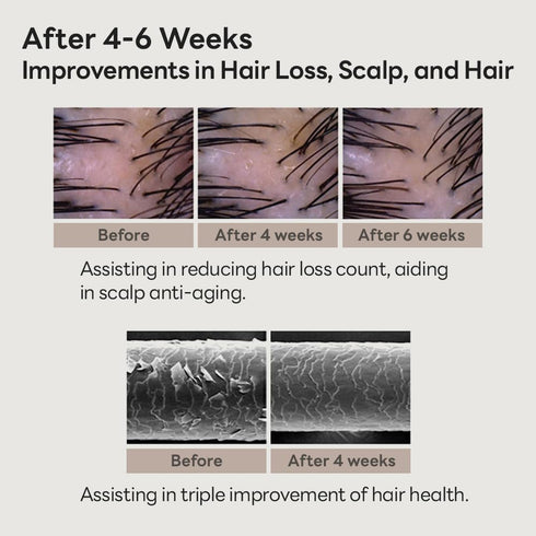 Scalp Intensive Shampoo - Peptide Shampoo Anti-Hair Loss Shampoo for Men Women Korean Hair Regrowth & Thickening with Panthenol Biotin, Paraben Fr...