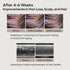 Scalp Intensive Shampoo - Peptide Shampoo Anti-Hair Loss Shampoo for Men Women Korean Hair Regrowth & Thickening with Panthenol Biotin, Paraben Fr...