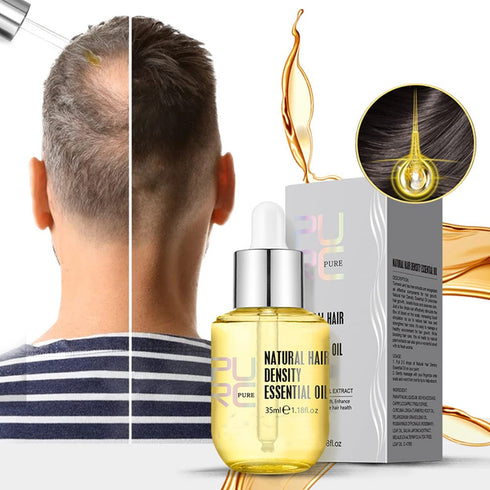 Hair Growth Density Essential Oil, Hair Growth Oil, Natural Hair Growth Essence Oil, Hair Care Essential Oil Reduce Hair Loss (2pcs)...