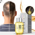 Hair Growth Density Essential Oil, Hair Growth Oil, Natural Hair Growth Essence Oil, Hair Care Essential Oil Reduce Hair Loss (2pcs)...