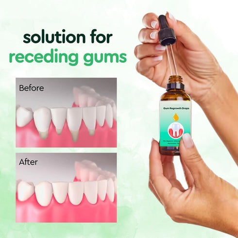 3PCS DentiZen Gum Regrowth Drops, Gum Relief Drops, Natural Gum Liquid Drops Mouthwash, Dentizen Gum Gel, Rejuvenate Your Gums with Ease...