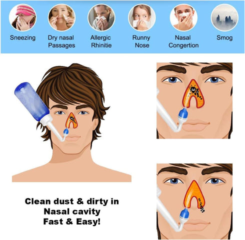 AQUAMASTER 2PCS-Pack Sinus Rinse Kit - Neti Pot - Nose Cleaner - 10oz 300ml Nasal Wash Bottle with Moisturizing Nasal Sprays Storage Bag for Adult...
