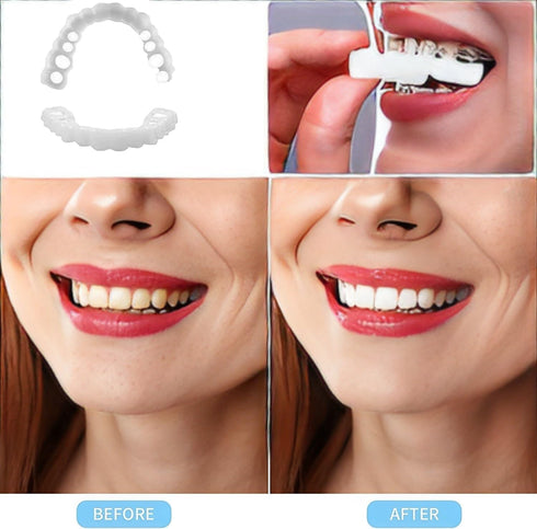 Men's and Women's Temporary Cosmetic Confident Smile...