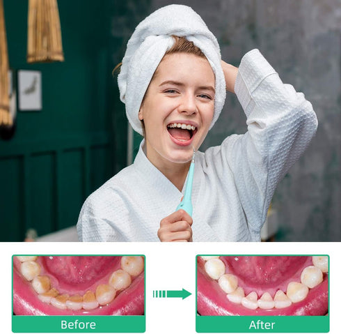 Electric Dental Calculus Remover, Sonic Tooth Scraper Plaque Tartar Stain Remover for Teeth High Frequency Vibration Teeth Cleaning Tools Kit with...